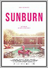 Sunburn Sunburn
