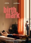 Birthmark