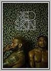Red Skin