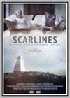 Scarlines