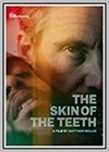Skin of the Teeth (The)