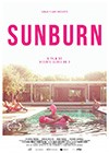 Sunburn-2018.jpg