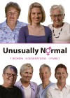 Unusually Normal