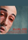 Blind Eye