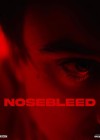Nosebleed